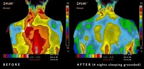 Thermal imaging comparison showing reduced inflammation after grounded sleep