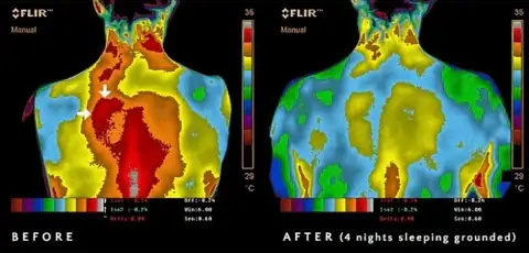 Thermal imaging comparison showing reduced inflammation markers before and after four nights of grounded sleep